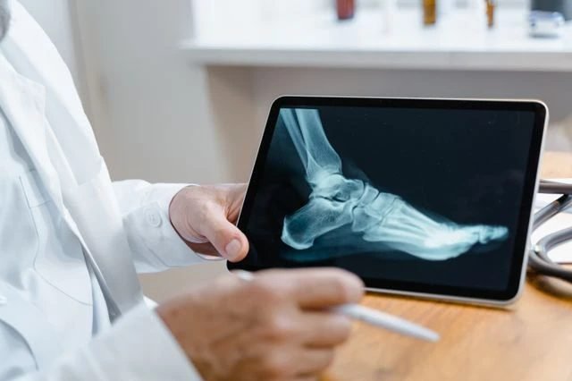 A clinician reviewing a foot X-ray on a tablet during a medical visit.